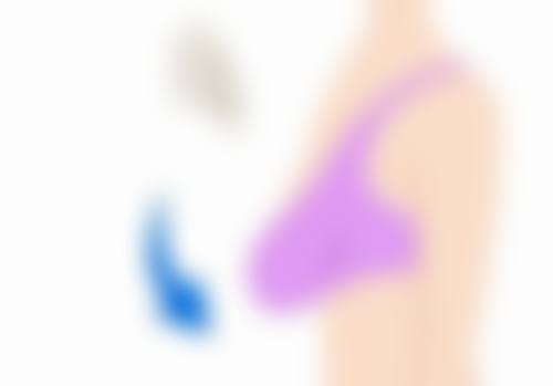 四、割了双眼皮一个月可以化妆吗之其他注意事项