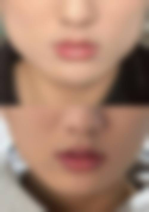 六、邹霞真实的患者评价