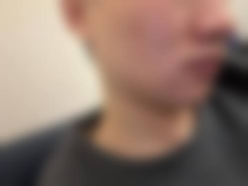 八、齐齐哈尔大千医疗美容诊所真实的患者评价