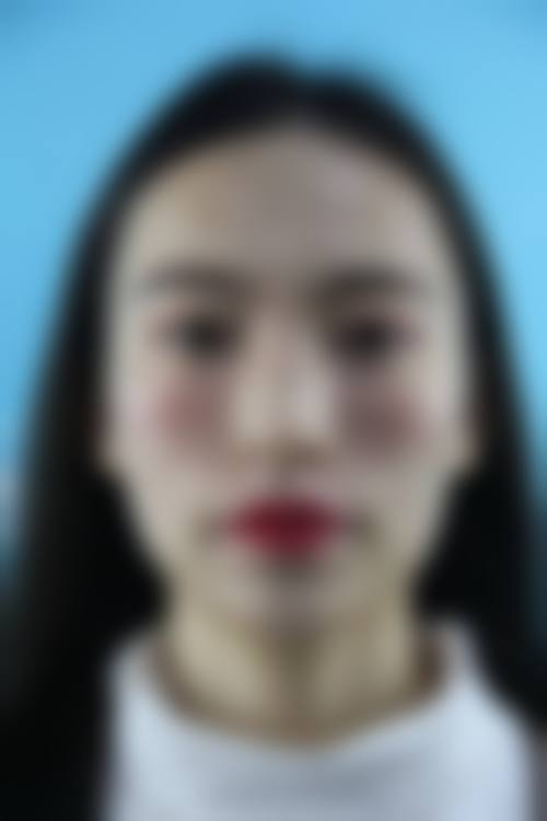 四、福州朵米亚医疗美容诊所特色项目