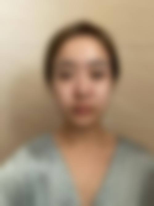 四、长治玛恩医疗美容诊所特色项目