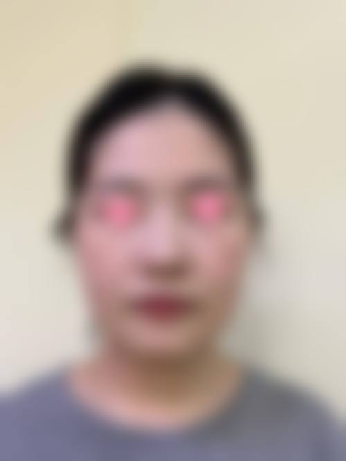 五、张华英怎么预约？