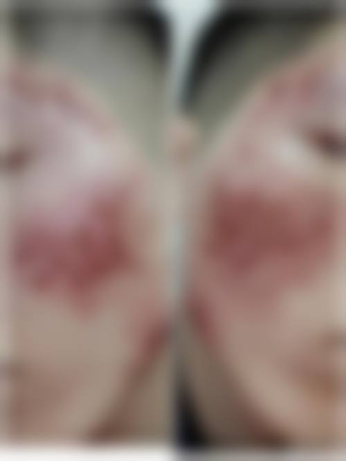 四、深圳恒丽医疗美容门诊部特色项目