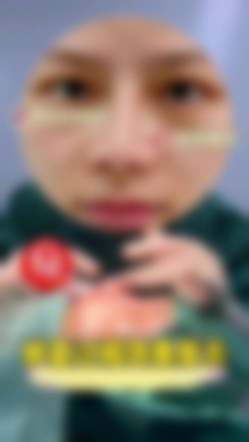 六、张华英真实的患者评价