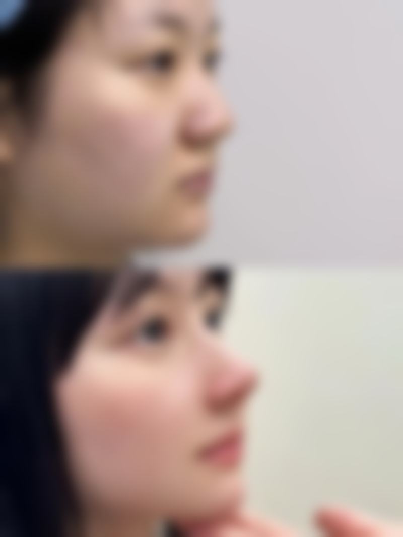 八、深圳沃美时光医疗美容诊所真实的患者评价