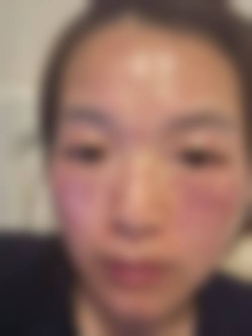 五、刘华荣怎么预约？
