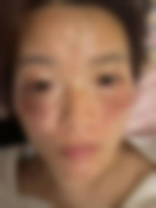 六、刘华荣真实的患者评价