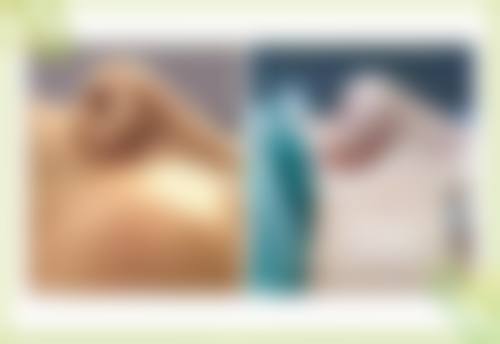 二、晋江聚医聚美整形医院怎么样？