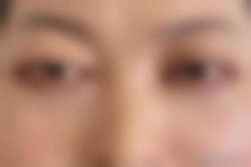八、广州丘山医学整形中 心真实的患者评价