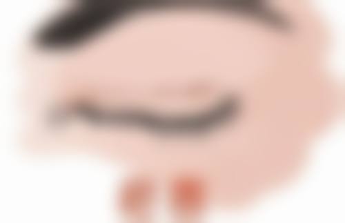 做的双眼皮眼间距窄了怎么办？多种有效方法助你改善眼部间距问题