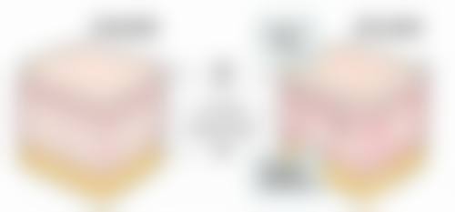 做埋线双眼皮会不会有什么风险和后遗症？常见风险及应对方法揭秘