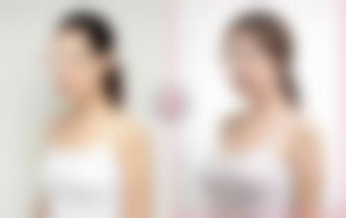 五、大连阎玲玉抗衰美容院价格表