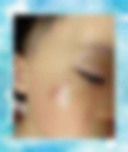 三、大连阎玲玉抗衰美容院诊疗项目有哪些？