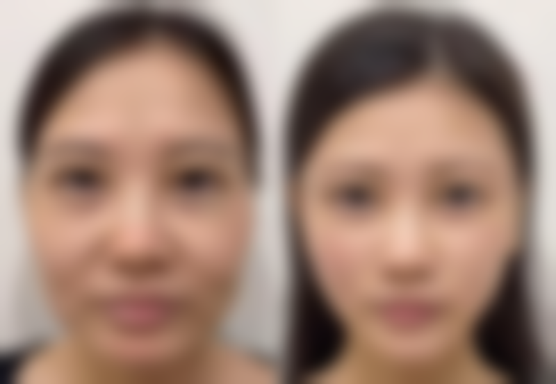 八、雅安斯卡娣美医疗美容门诊部真实的患者评价