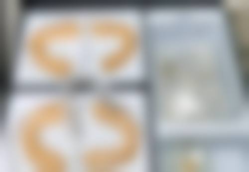 四、其他割双眼皮的方法