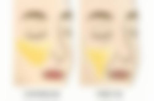 半肋骨隆鼻是永久性的吗？了解其效果持久性及影响因素，附相关图片解析 