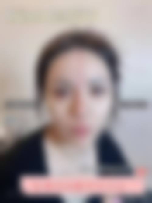 八、石家庄诚楠整形美容医院真实的患者评价