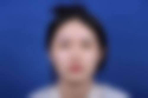 九、邵阳希美医疗美容真实的患者评价