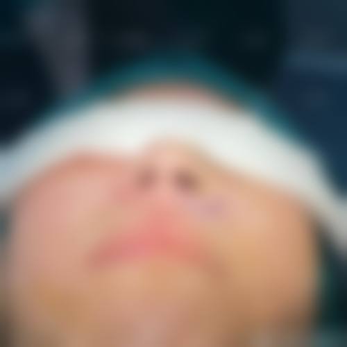 二、乌鲁木齐新生医疗美容门诊部怎么样？