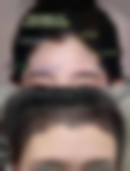 三、武汉瑞丽诗植发医院诊疗项目有哪些？