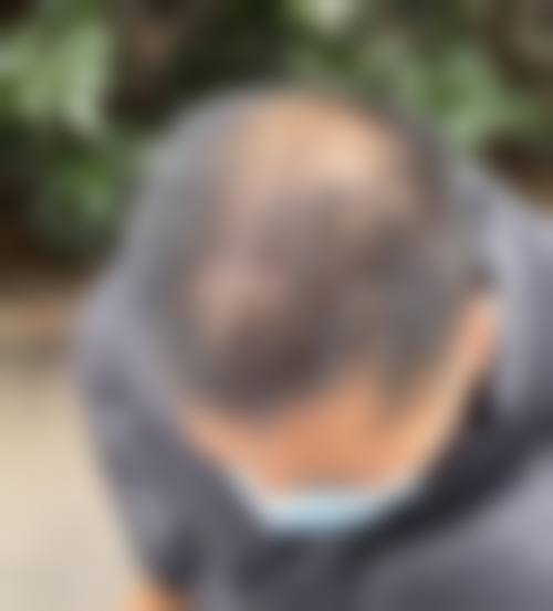 七、武汉瑞丽诗植发医院预约方式
