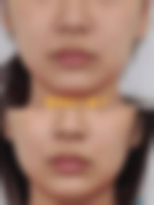 六、葫芦岛颐正医疗美容诊所价格表