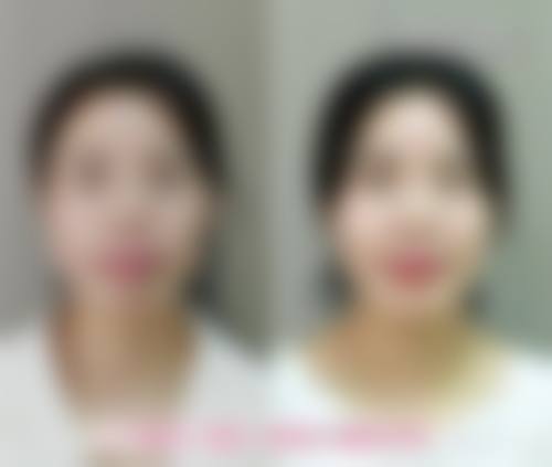八、濮阳修形美林医疗美容门诊部真实的患者评价