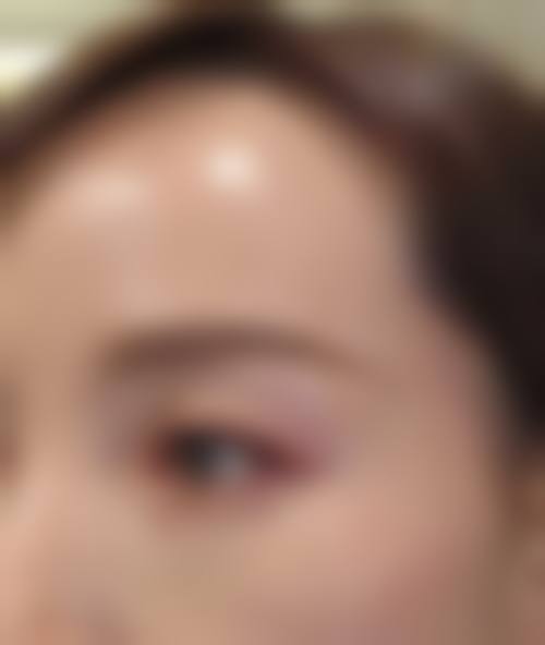 八、朝阳倾城医疗美容诊所真实的患者评价