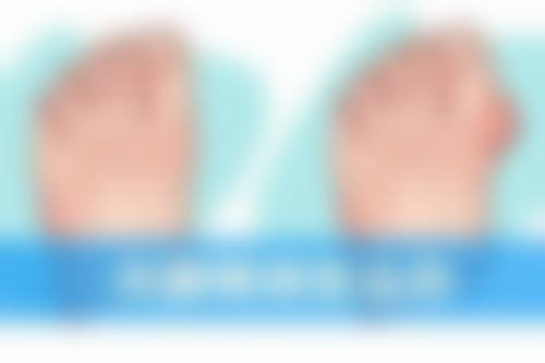 六、日常护理预防眼袋