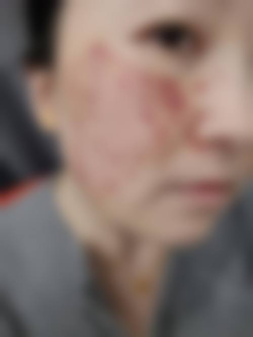 二、湖南常德辰格容妍医疗美容怎么样？