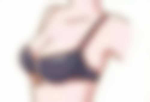 一、双眼皮手术与疤克简介