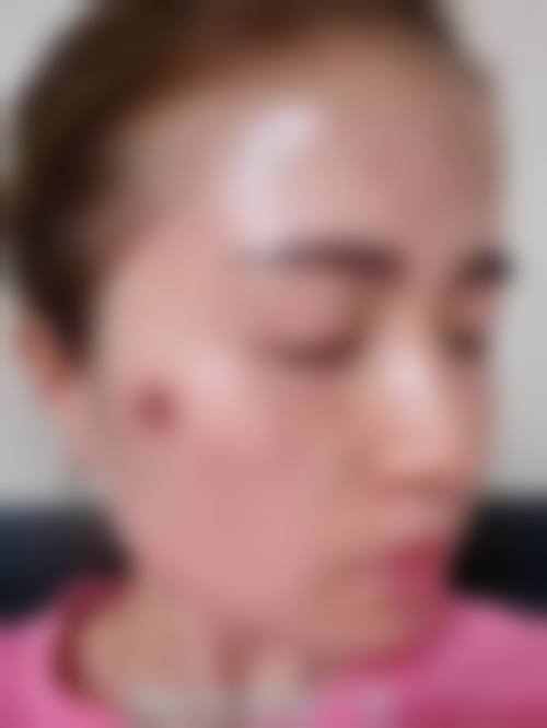 六、大理优拉医疗美容门诊部价格表