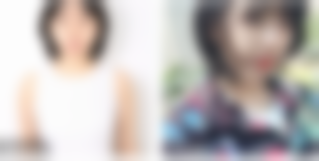 三、贵阳美莱进口冰点脱毛消费情况与保护