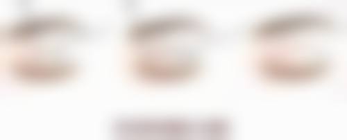 一、双眼皮手术的重要性及选择医院的关键