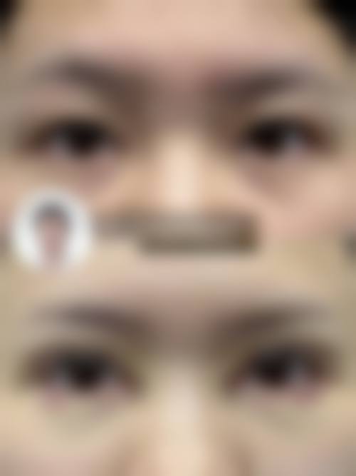 四、江门若如初见医疗美容诊所特色项目