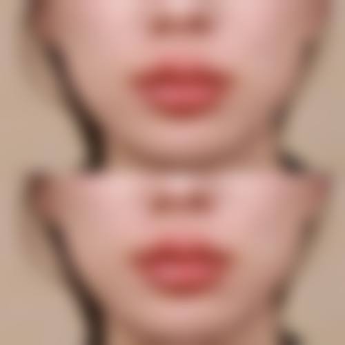 七、台中亞欣醫美整形診所预约方式