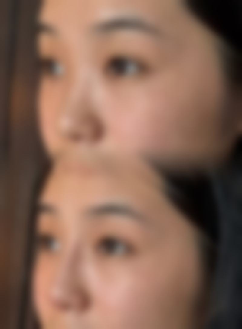 四、湖州倍美医疗美容诊所特色项目