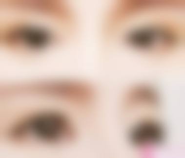 九、长沙瑞美整形医院真实的患者评价
