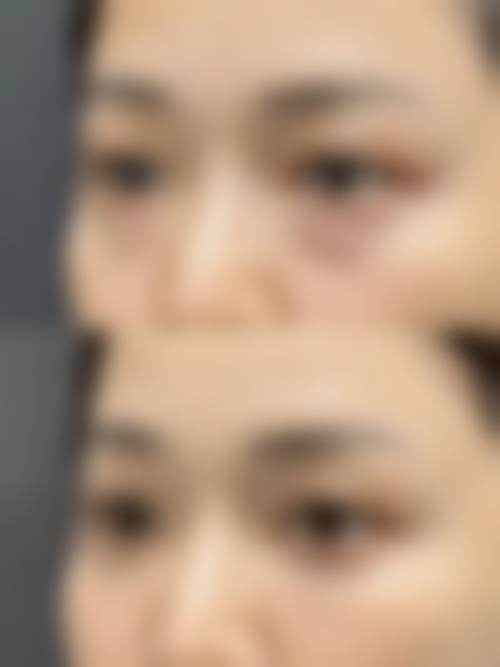 二、西安艾娜薇特美容医院怎么样？