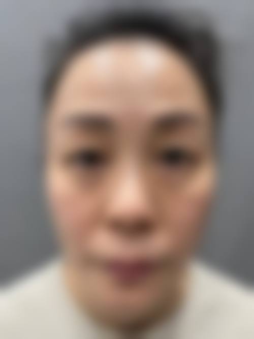 八、西安艾娜薇特美容医院真实的患者评价