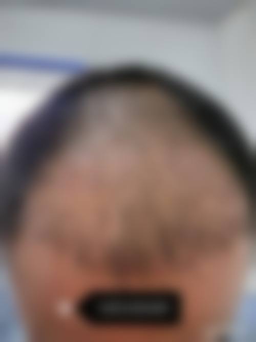 四、深圳澳美洛格整形医院特色项目