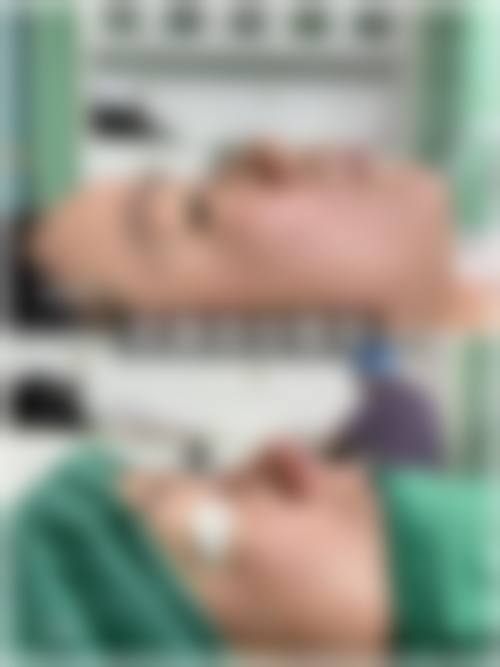 四、厦门张铭整医疗美容诊所特色项目