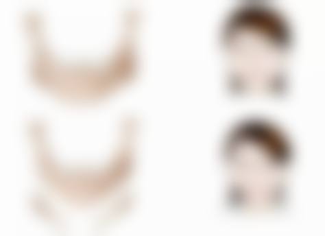 三、西安艾娜薇特美容医院诊疗项目有哪些？
