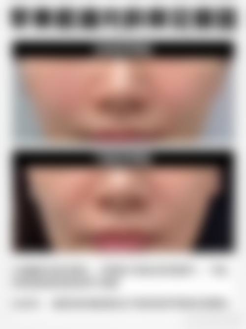 三、大连京城皮肤病医院诊疗项目有哪些？