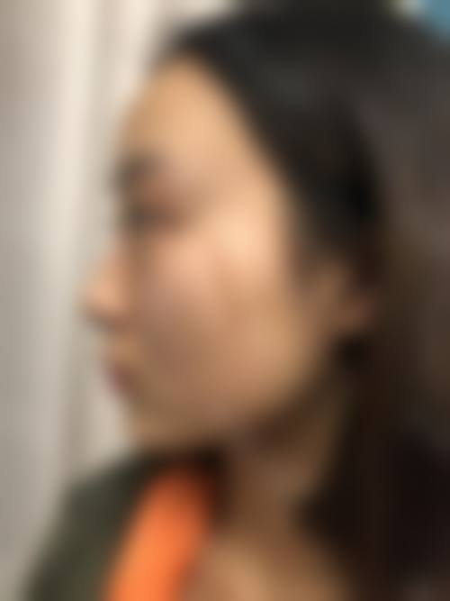 九、焦作民鑫医疗美容真实的患者评价