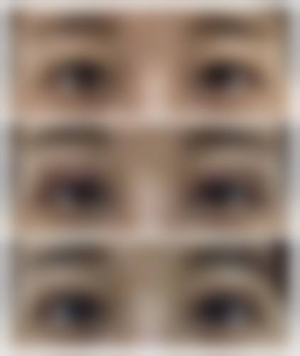 九、沾化县人民医院整形美容科真实的患者评价