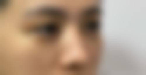 四、深圳颜伊医疗美容门诊部特色项目