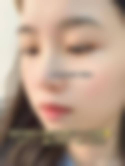 九、台湾全美整形診所真实的患者评价