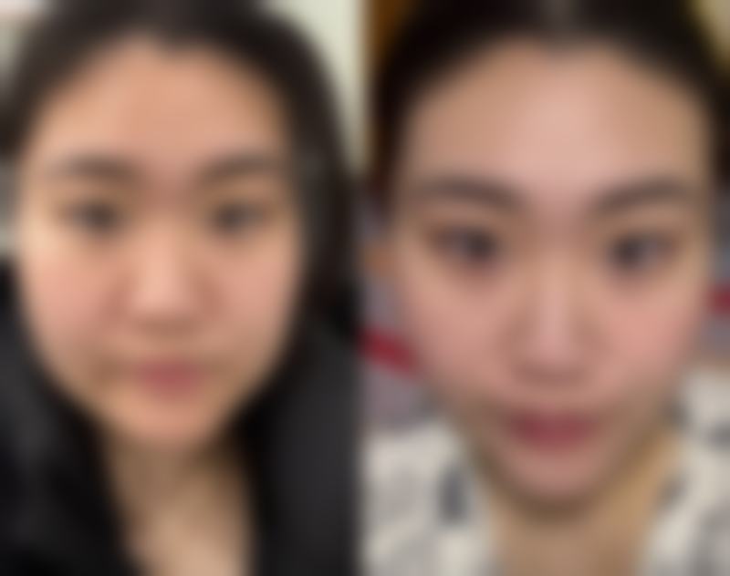 五、深圳颜伊医疗美容门诊部价格表