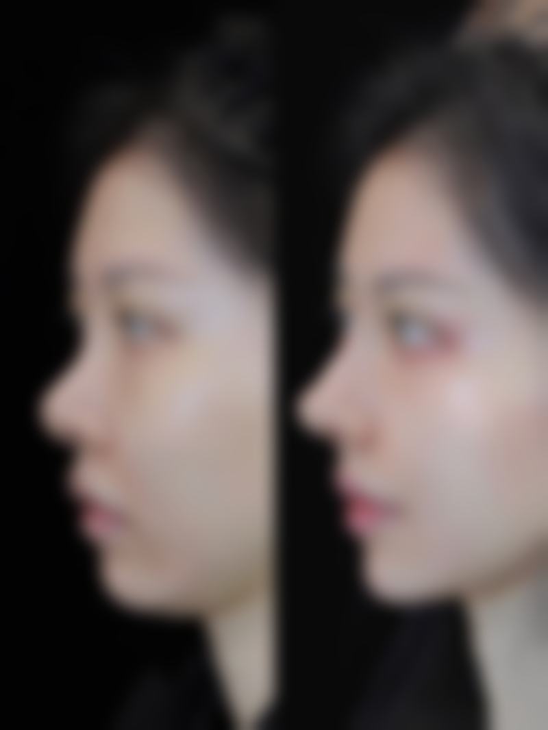 三、沾化县人民医院整形美容科诊疗项目有哪些？